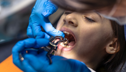 Tooth Extraction in Johor Bahru