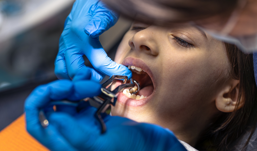 Tooth Extraction in Johor Bahru